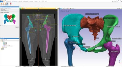Ansys Health Industry Webinar Series