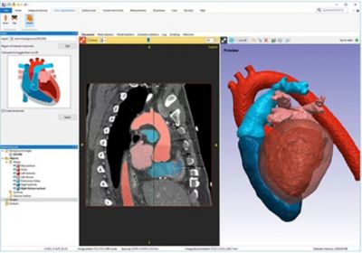 3D heart scan