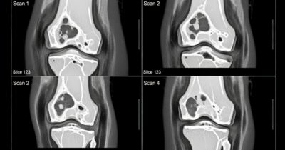 Accelerating 3D Medical Image Segmentation with Machine Learning