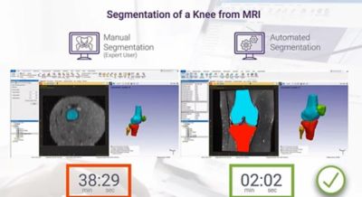 3D knee MRI segmentation