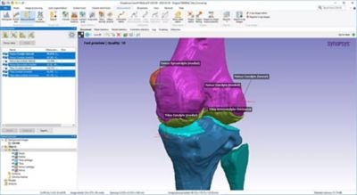 3D knee scan