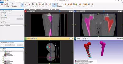 5 Top Tips to Speed Up Segmentation of Cardiovascular and Orthopedics Image Data in Simpleware Software