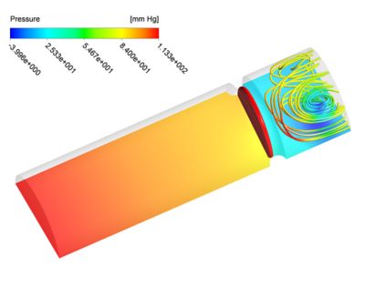 Using Ansys for Doctorial Research in Cardiovascular Engineering