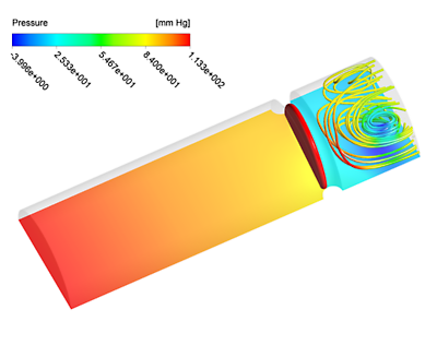 Using Ansys for Doctorial Research in Cardiovascular Engineering