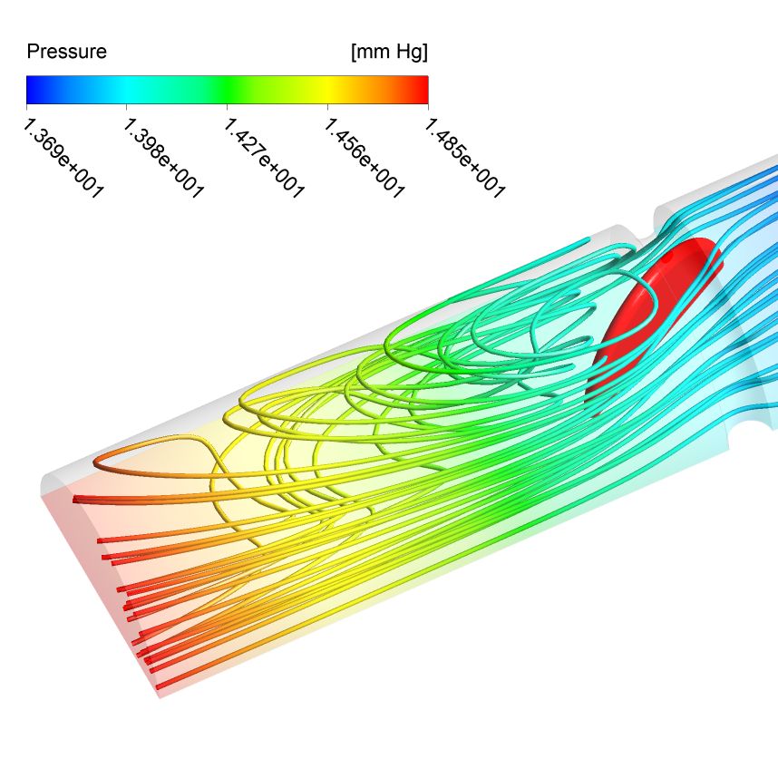 Using Ansys For Doctorial Research In Cardiovascular Engineering