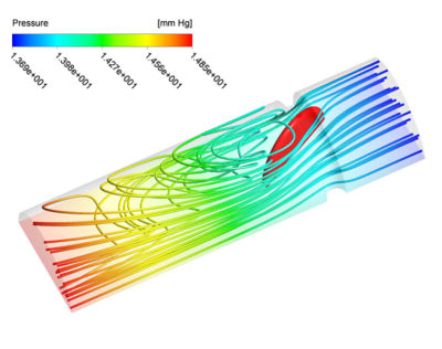 Figure 2: 0D-3D coupled simulation. Pressure contour plot along with pressure streamlines during contraction (left) and relaxation (right) of the ventricle and heart.
