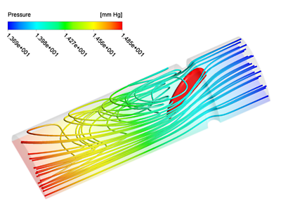 Figure 2: 0D-3D coupled simulation. Pressure contour plot along with pressure streamlines during contraction (left) and relaxation (right) of the ventricle and heart.