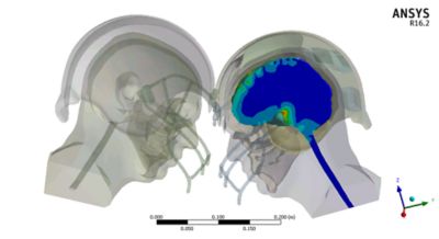 Simulation of shock waves bouncing around inside a skull from a concussion