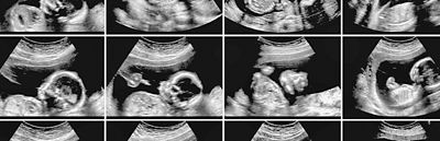 King's College banner