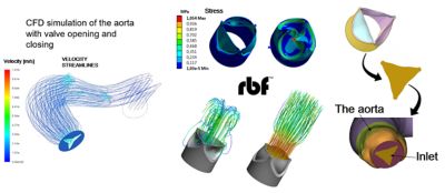 Aortic valve RBF meshing