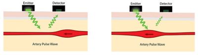 Artery pulse wave