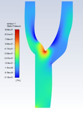 Base model of an artery