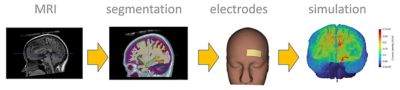 Brain wotkflow