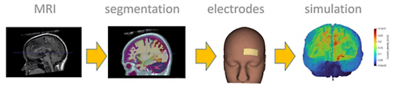 Brain wotkflow