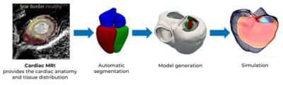 Cardiac simulation