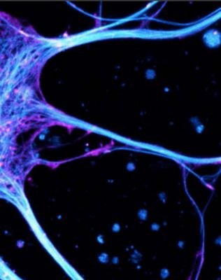 cornell-university-case-study