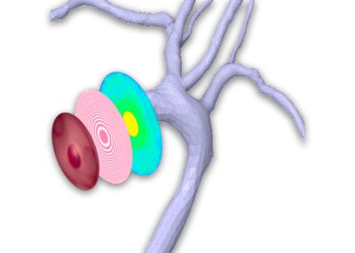 cover-picture-metalens-endoscope2