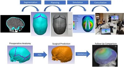 craniosynostosis-workflow.jpg