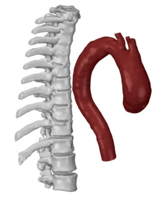 distance-between-aorta-and-spine