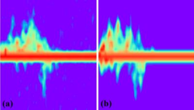 Doppler spectogram