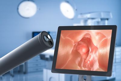 example-of-an-endoscope