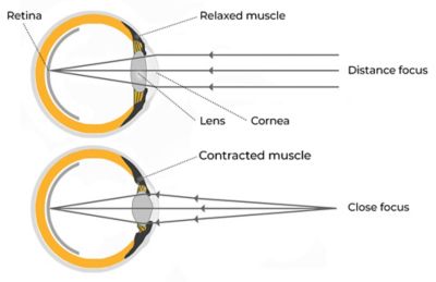 Eye focus comparison