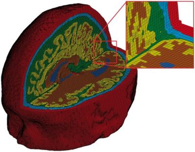 fea-brain