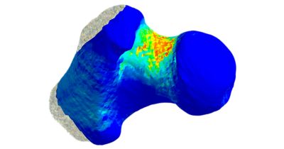 Human femur simulation