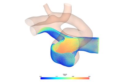 Freeflow Periodic Continuous Injection