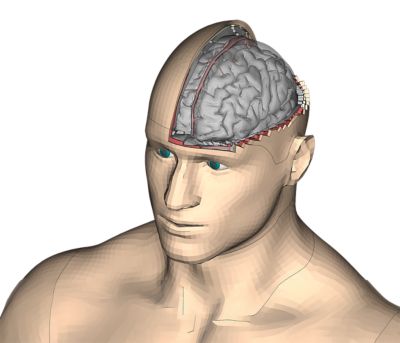 hans-brain-pic1