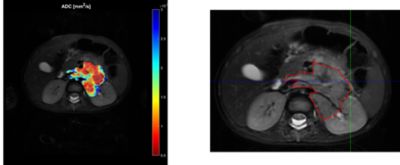 Imaging types