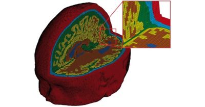 Predicting Patient-Specific Brain Injury Outcomes With Simulation
