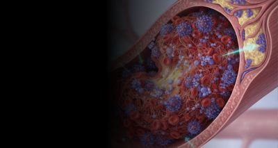 Copy of Untitled Design - Improving the Biocompatibility of Medical Devices through Thrombosis Modeling -AEM-Banner