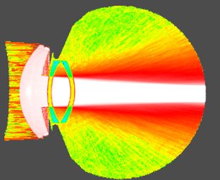 intraocular-scattering