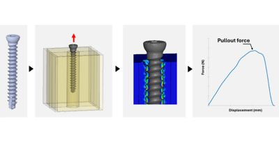 Transforming Orthopedic Screw Design With FDA Approved In Silico Testing