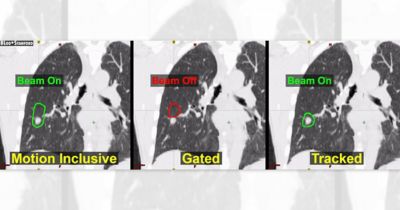 Comparison of inclusive, gated, and tracked 