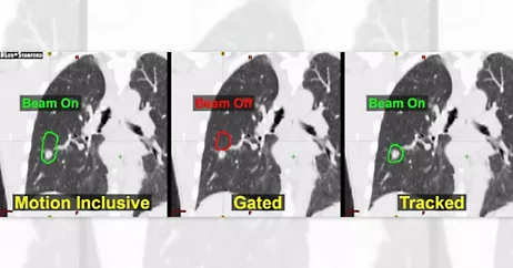 Targeting Cancer in a Flash with Simulation, Radio Frequency, and Electromagnetics