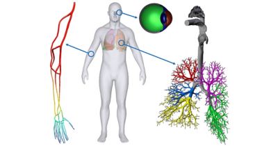 Students Explore Biomedical Research with Ansys CFD