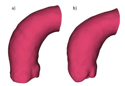 properties-of-artery-walls