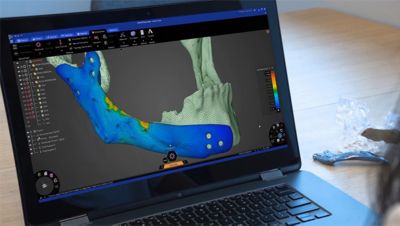 repairing-bone-loss-with-simulation-2.jpg