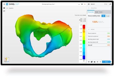 Simq OSP surgical planning tool