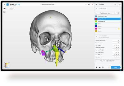 Simq RPE surgical planning tool