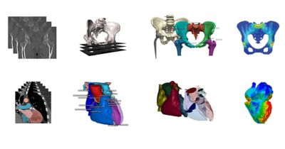 From Scan to Simulation: Advancing Medical Innovation in a Single Solution