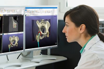 Ansys Simpleware Medical