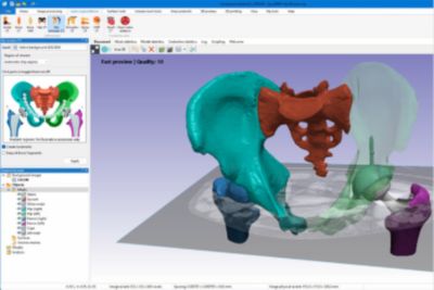 Ansys Simpleware Medical