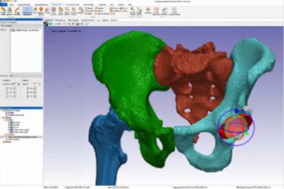 Ansys Simpleware Medical