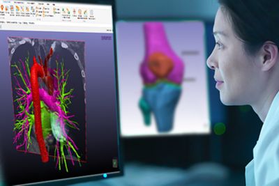 Ansys Simpleware Medical