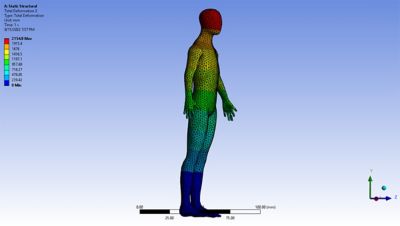 Static structure total deformation