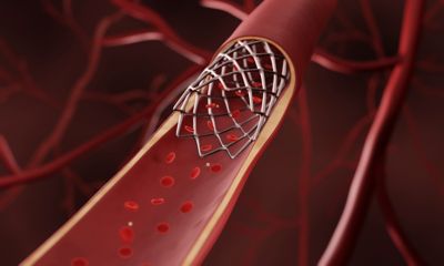 Arterial stent, Atherosclerosis treatment