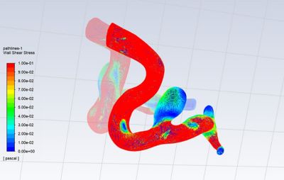 Wall shear stress within artery